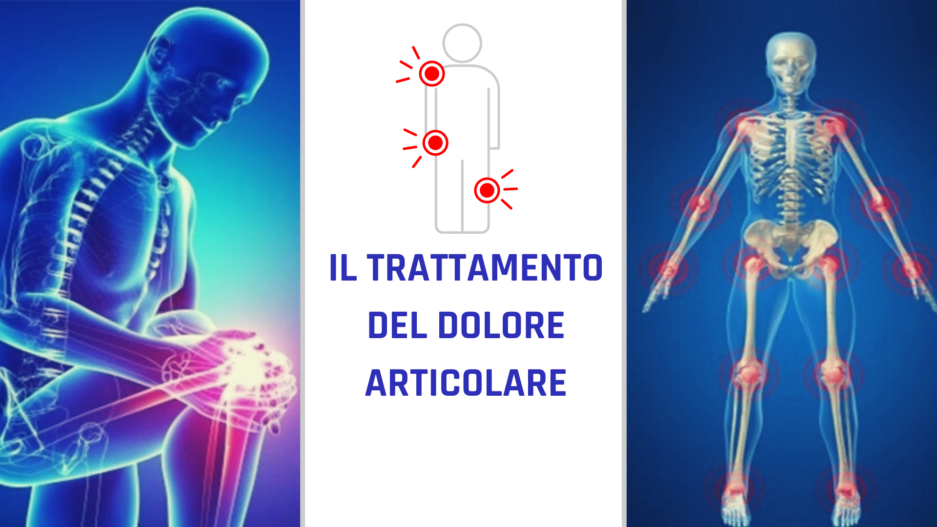 TRATTAMENTO DEL DOLORE ARTICOLARE